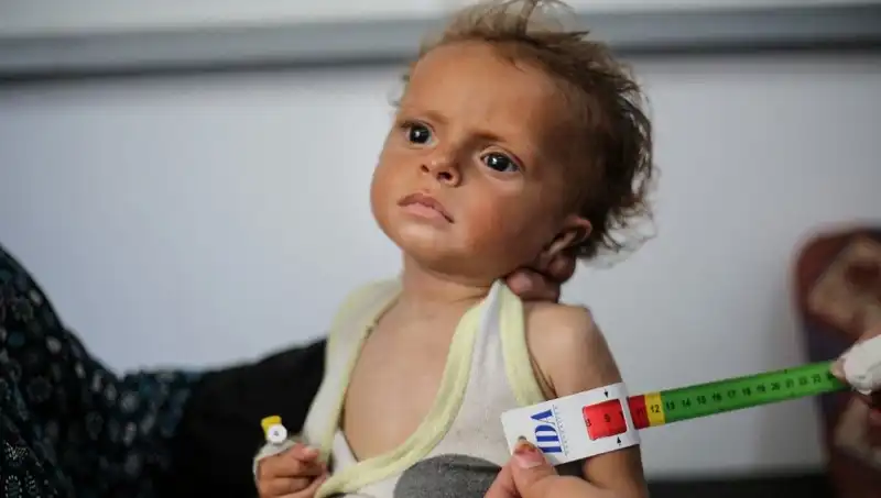 İngiltere, 300 Gazzeli Çocuğa Yeni Bir Yaşam Fırsatı Sunacak