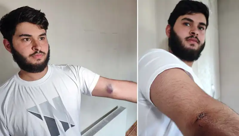 Bahçeye Kaçan Top, Mahallede Geleneksel Kutlamayı Alt Üst Etti
